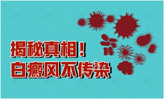 白癜风患者同居会不会传染