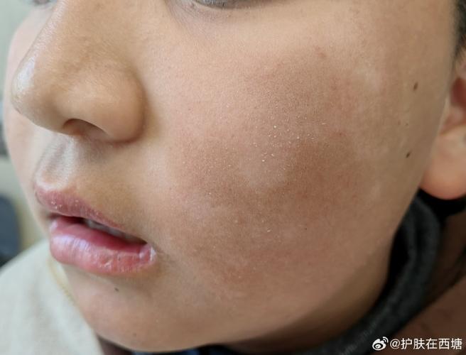 �ǰ�����־ �����ż�