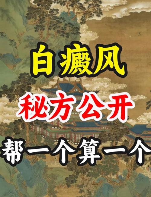 成都白癜风治疗权威机构排行出炉 白癜风遗传孩子问题需关注 成都白癜风治疗权威机构排行出炉 白癜风遗传孩子问题需关注