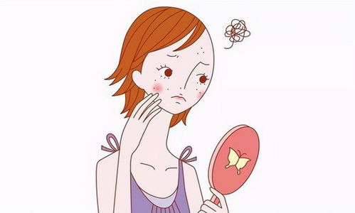 白癜风有哪些药膏可治 白癜风有哪些药膏可治