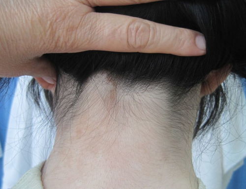 ��ҽ�������Ʒ��� ���ư���������ҽԺ