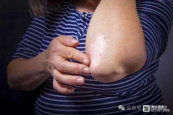 �ձ�ҽԺ�ΰ���ҩ��