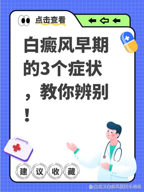 小孩白癜风的初期症状 南阳哪所医院治白癜风好 小孩白癜风的初期症状 南阳哪所医院治白癜风好
