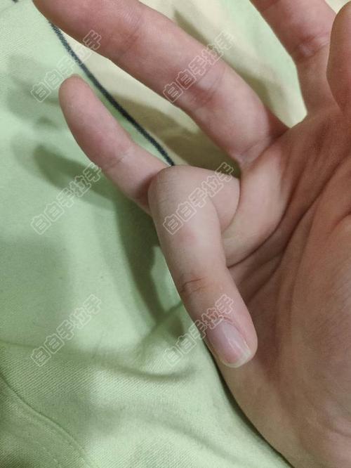 �����л��а���ᴫȾô �Ͼ��ΰ���ĵ�ҽԺ