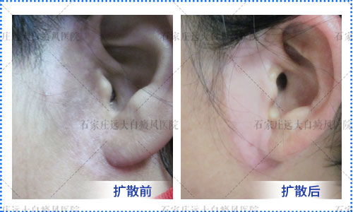 ����������ư���_������ҩ����ʲô��