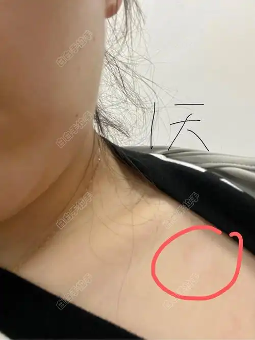 重庆治白癜风去哪家医院好 头部怎么预防白癜风呢 重庆治白癜风去哪家医院好 头部怎么预防白癜风呢