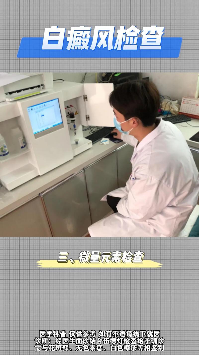 淮北治白癜风到哪里 头部怎么预防白癜风呢 淮北治白癜风到哪里 头部怎么预防白癜风呢