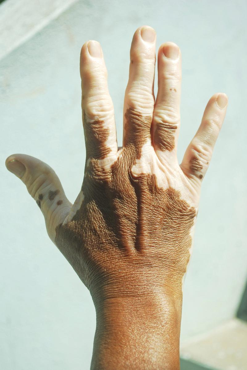 陈若琳的个人资料简介 陈若琳的个人资料简介