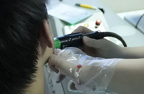 白癜风有效解决方案 白癜风如何根治 白癜风有效解决方案 白癜风如何根治