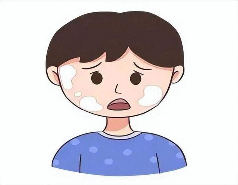 控制白癜风最快的方法 控制白癜风最快的方法