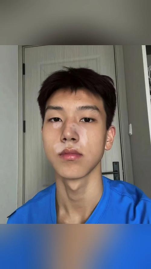 �ɶ���������ҽԺ��������������ɢ����Щԭ���й�