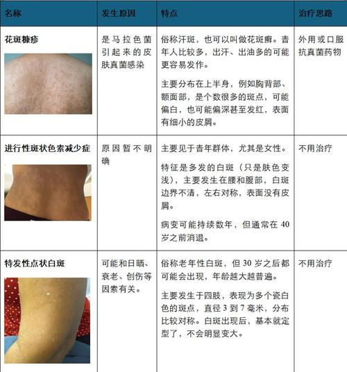 ������ʲô���ư���