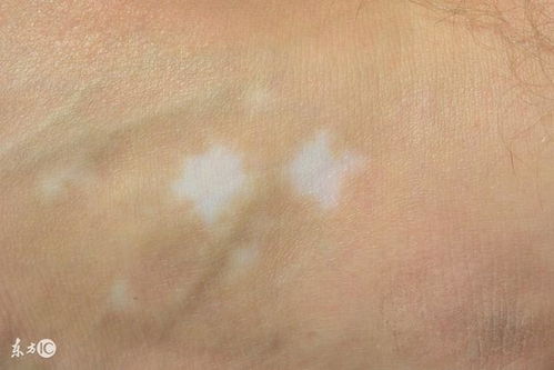 �޻۾��漮 �޻۾���ƽ