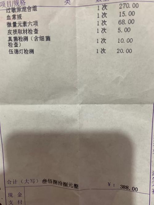 白癜风软膏多少钱 白癜风软膏有用吗 白癜风软膏多少钱 白癜风软膏有用吗