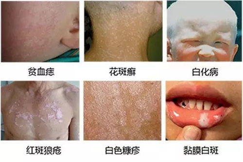 �ڽ��ΰ����ҽԺ�ĸ� �װߺͰ���������ʲô