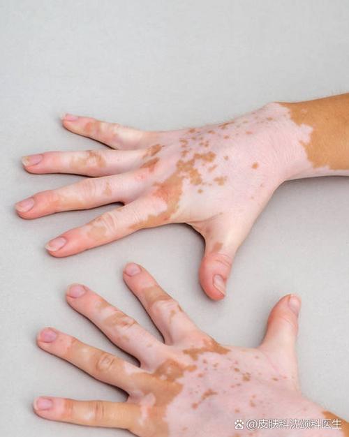 喝牛奶致癌 喝牛奶得癌症几率大吗 喝牛奶致癌 喝牛奶得癌症几率大吗