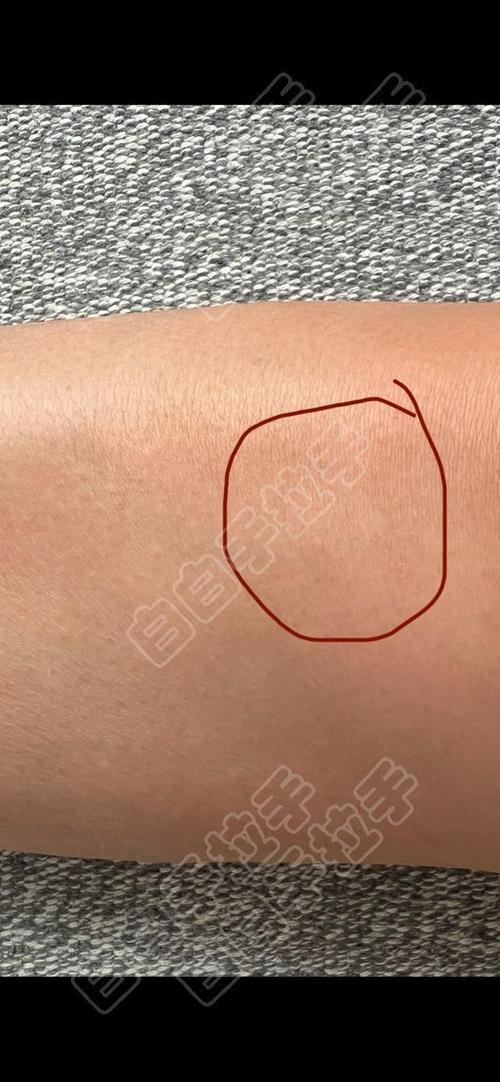 �����ΰ���ȥ����� ʲôԭ����ɰ���