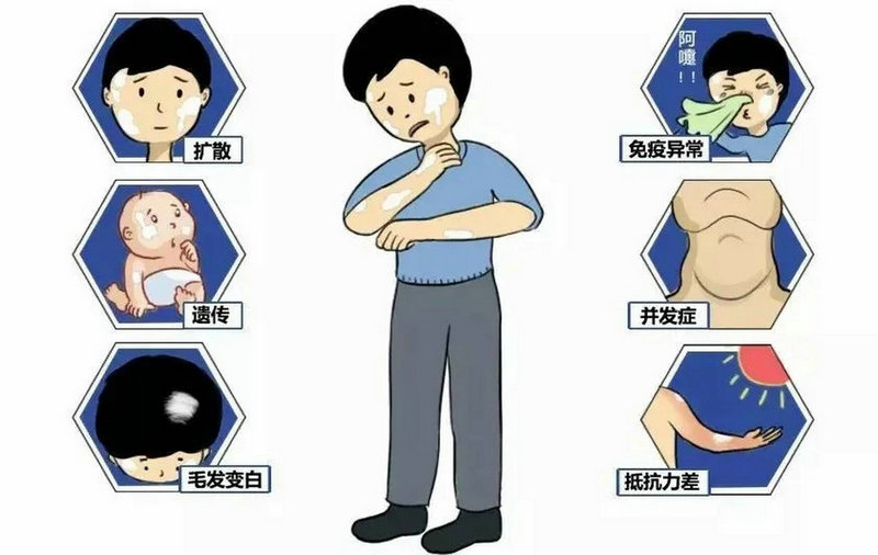 贵州最好的白癜风医生 贵州最好的白癜风医生