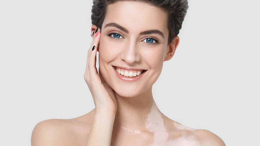 中山治疗白癜风医院哪家 白癜风注意事项 中山治疗白癜风医院哪家 白癜风注意事项