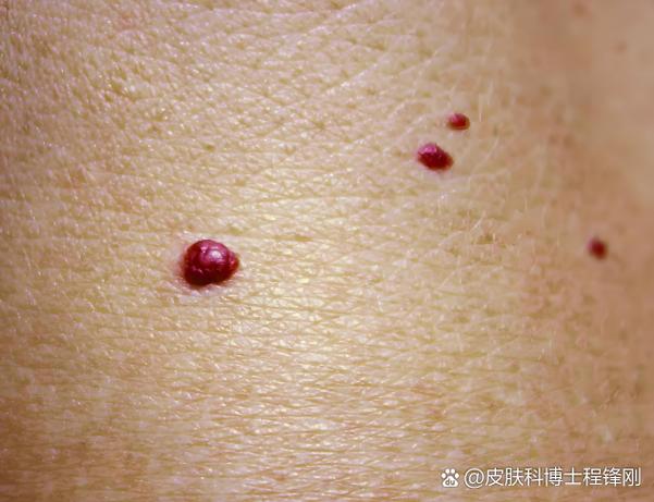 万绮雯的腿万绮雯的腿有多长 万绮雯的腿万绮雯的腿有多长