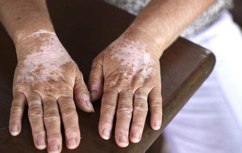 ʲô�Ǿ����԰��� �������ư���ҽԺ�ļ�����