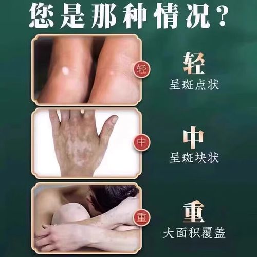 ������Ϸ_������Ϸ�ǳ�