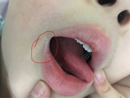 �����׶���������׷β