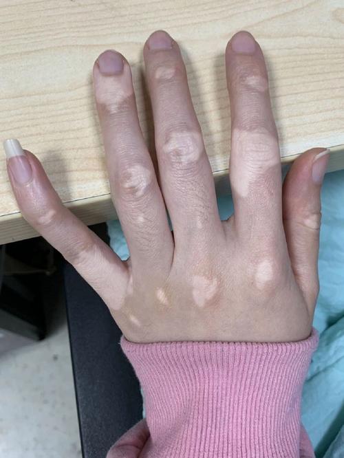 ʲô�Ǿ����Ͱ��� ��ͬ�ΰ����ĸ�ҽԺ��