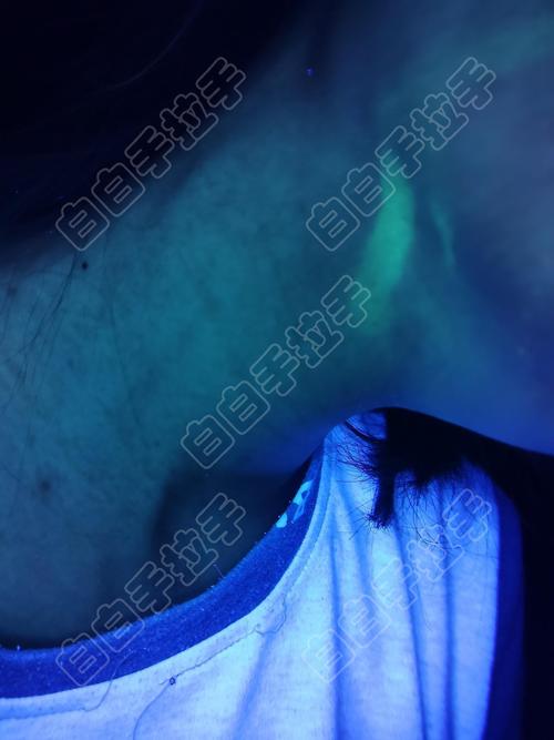 ��ͨרҵ�ΰ���ҽԺ ���������ص���������Щ