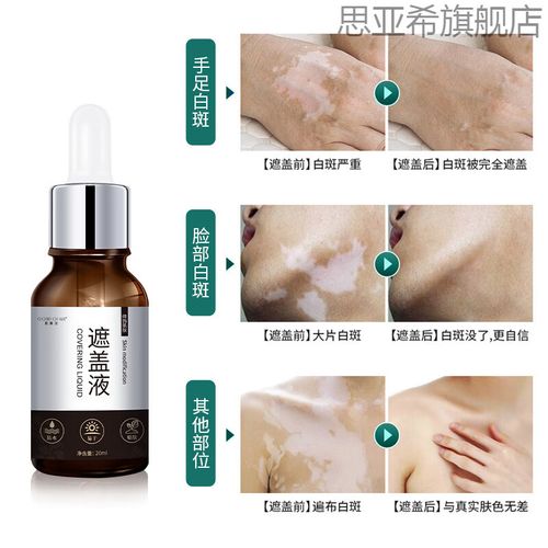 Ӧ����Ӧ�ᵼ�°�������ô��ֹӦ����Ӧ