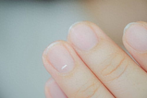 套套的作用 套套的作用是什么 套套的作用 套套的作用是什么