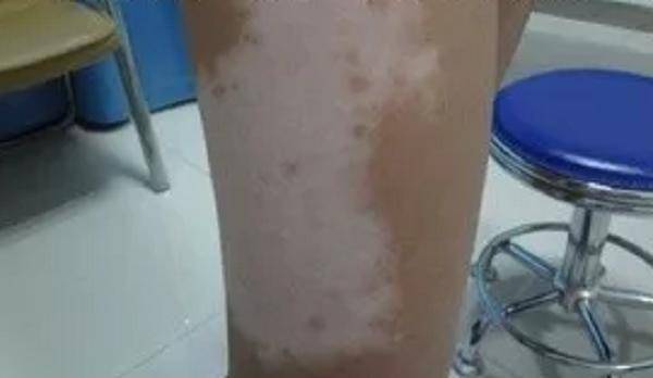 ��Ա�޼��� ��Ա�޼�������׷��ѩ���������