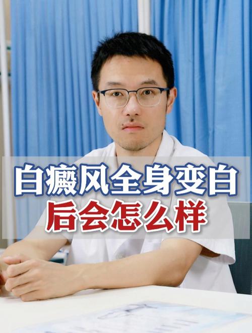 邢佳栋年轻邢佳栋颜值 邢佳栋年轻邢佳栋颜值