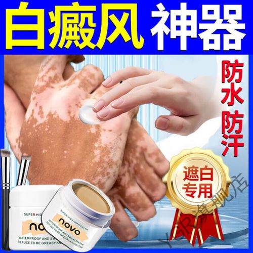 天水市白癜风药物报销 天水市白癜风药物报销