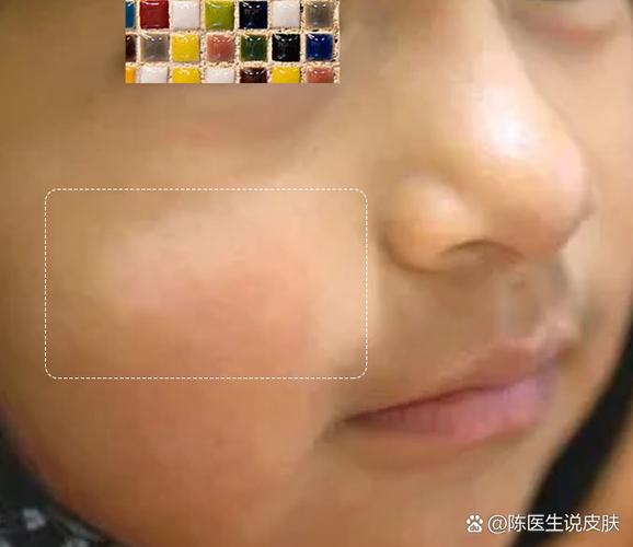 רҵҽԺн ڿ ½չ¯