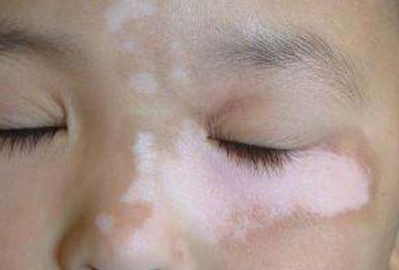 ���糤����Ч��ԭ����ʲô��