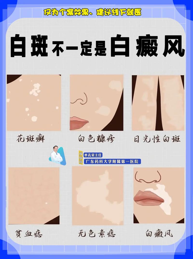 Ϋ�����ư����ҽԺ����� �����ÿ����κ�