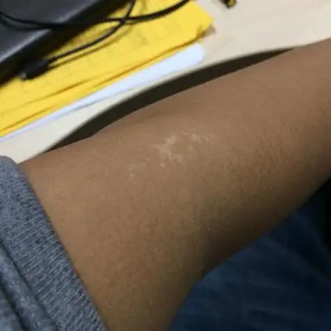 ��ӥ���� ��ӥ����ϲ��������