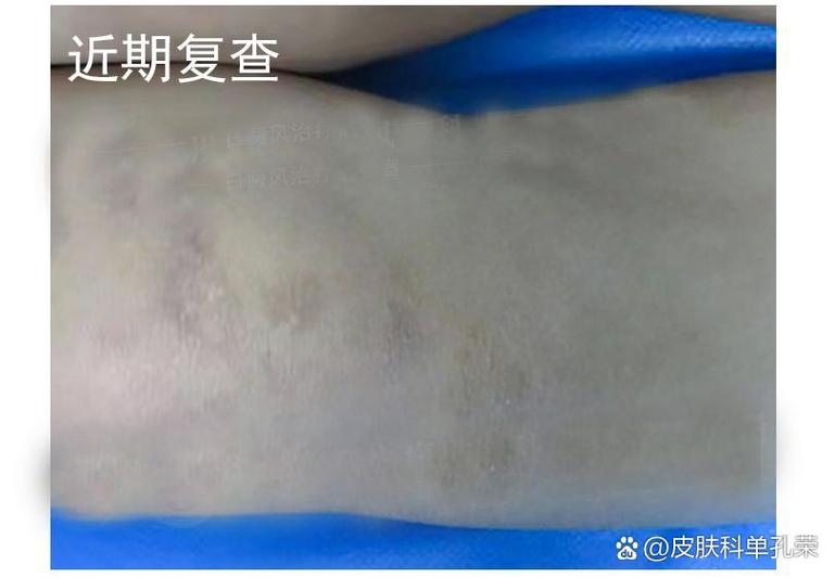 ������ҩ����ָܻ�