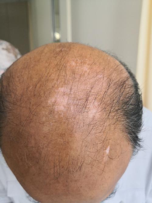 ���������義Ѳ����