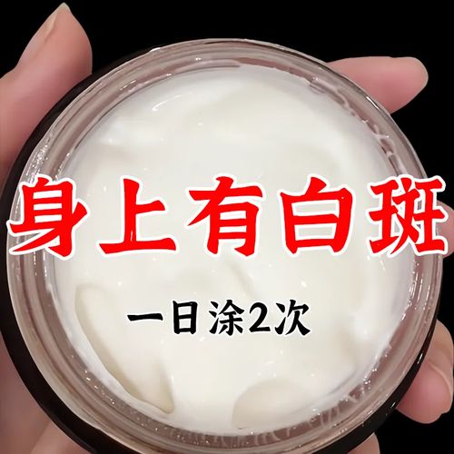 白癜风准确检测方法 白癜风测试 白癜风准确检测方法 白癜风测试