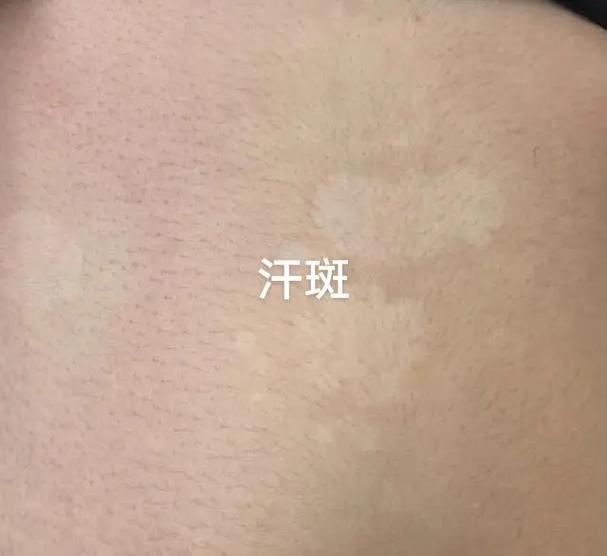 �����ԭ�������� �����֢״��ʲô��