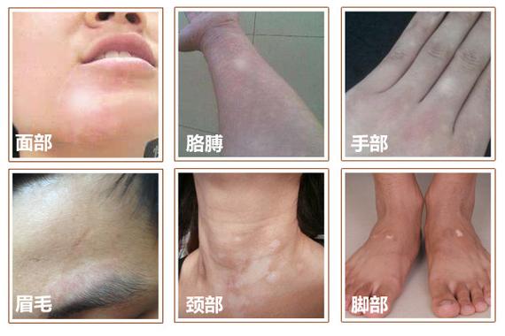 纳塔莉娅波克隆斯卡娅 纳塔莉娅波克隆斯卡娅