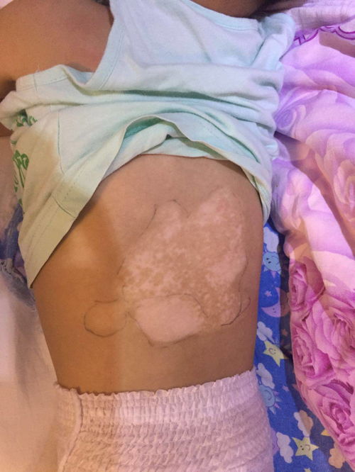 黄金鸡蛋_黄金鸡蛋的正确做法视频 黄金鸡蛋_黄金鸡蛋的正确做法视频