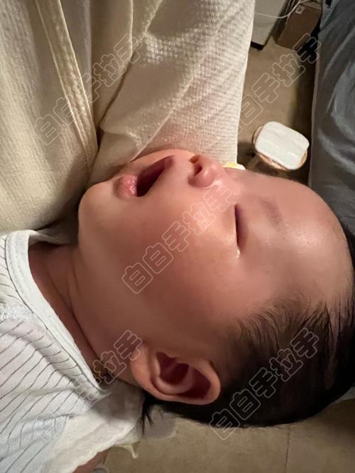 怎么判断白癜风的病情 怎么判断白癜风的病情