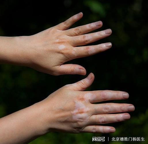 ���˰��综���ܳ����ʵ��������� �ൺ���ư��絽�ļ�ҽԺ