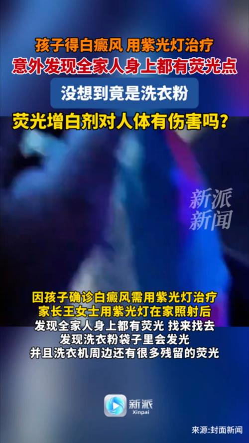 白癜风会隔代遗传吗 长沙哪家医院治白癜风 白癜风会隔代遗传吗 长沙哪家医院治白癜风