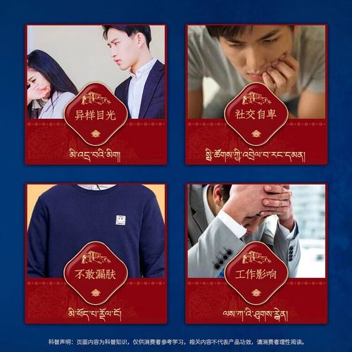 怎么发现白癜风长在头部 怎么发现白癜风长在头部