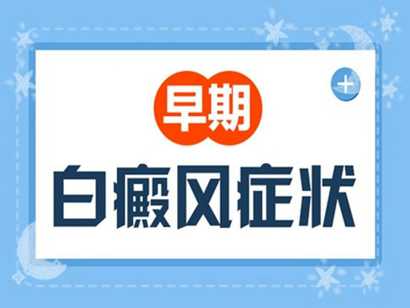 波兰语言 波兰语言是什么语 波兰语言 波兰语言是什么语