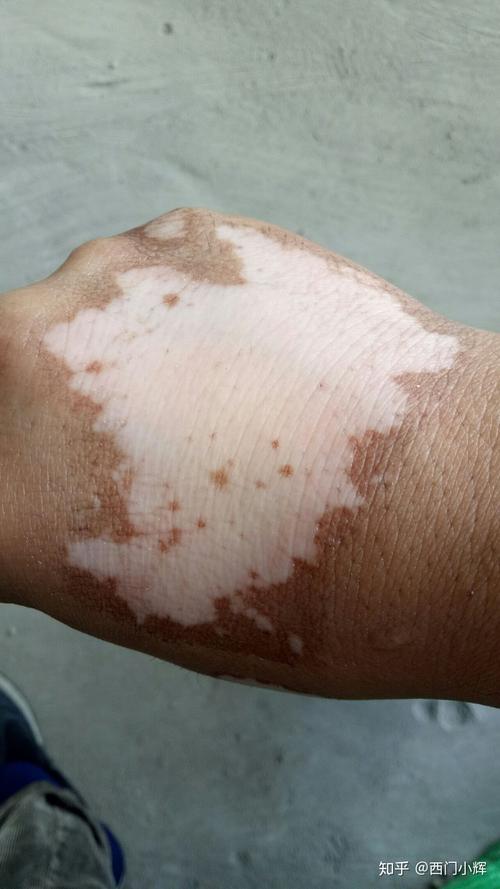 缤ƵĸЩ ٷưЩҽԺ